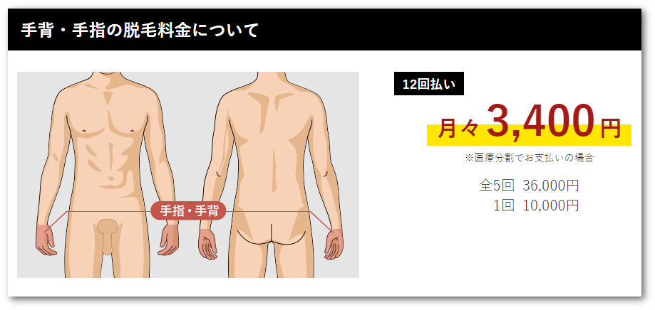 ゴリラクリニック指毛脱毛料金